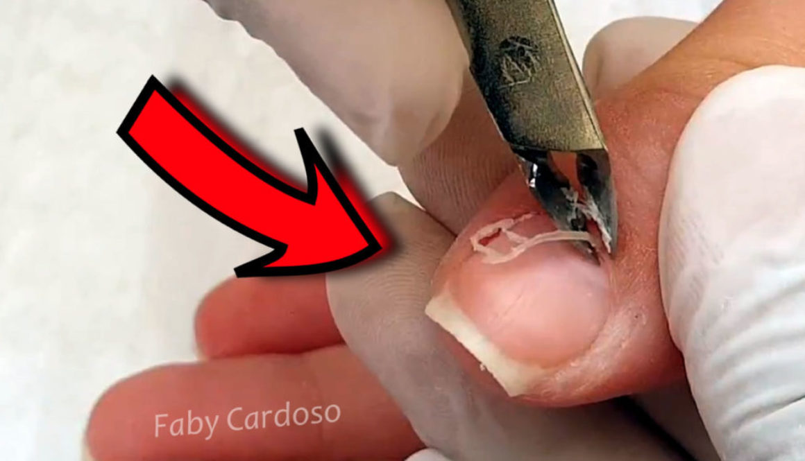 Como Remover A Cutícula Do Dedão Por Faby Cardoso